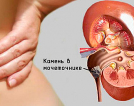 О чем говорят «камни»